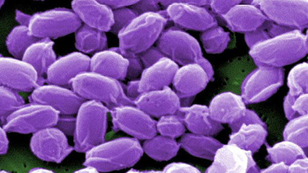 anthrax Microscopic image of anthrax