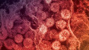 MERS covid Microscopic image of MERS