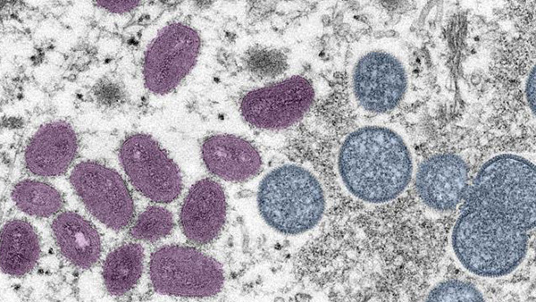 — title missing — Microscopic image of Mpox virus