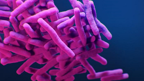 tuberculosis Microscopic image of Tuberculosis