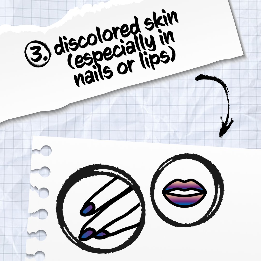 3. discolored skin (especially in nails or lips)