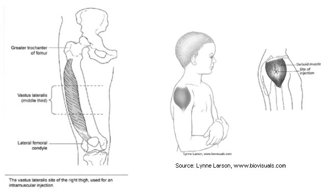 vaccine figure 5 Image of vastus lateralis muscle and site of the upper and right thigh used for intramuscular injections in babies. Image of youth and close up of deltoid muscle site of injection. Source: Lynne Larson, www.biovisuals.com.