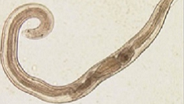 Enterobius vermicularis pinworm Enterobius vermicularis pinworm