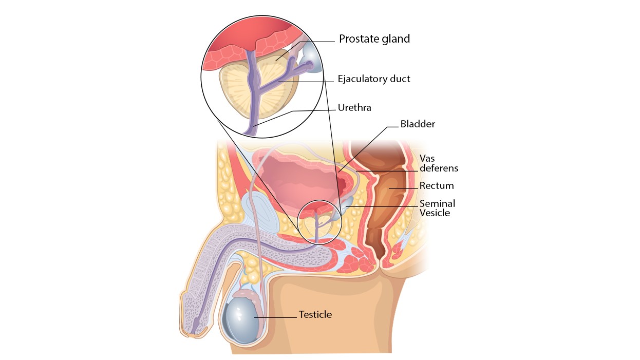 Prostate Diagram Diagram showing the location of the prostate