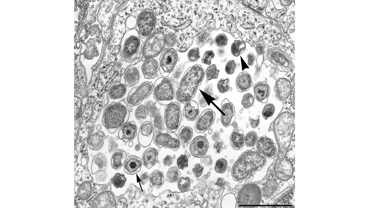 Electron micrograph Electron micrograph of Chlamydia psittaci cells.