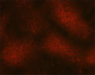 Negative dFA Dark red on a black background