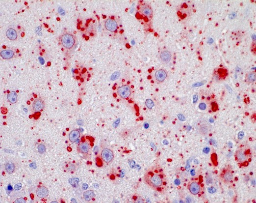 Positive IHC Positive IHC; rabies-infected neronal cells of the brain