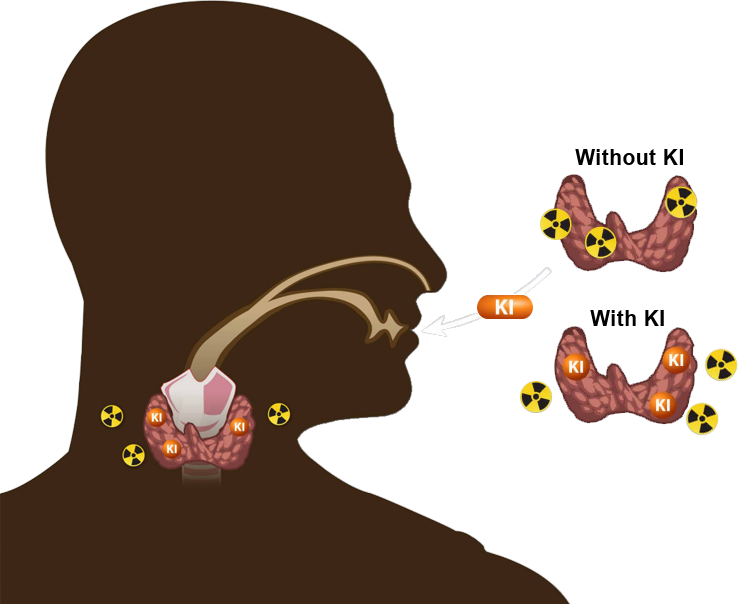 How KI Works vector graphic showing where KI goes in the body