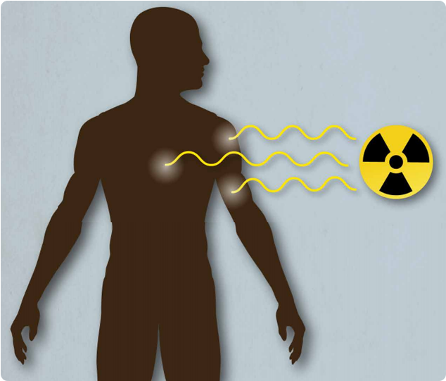 Radiation Health Effect Graphic image Graphic depicting a person being impacted by a radiation source