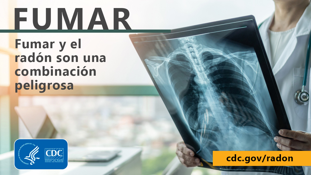 Radon and smoking social media Spanish A photo of a doctor with face out of shot holding plain filmlung X-ray. In large title font at top left it reads, "FUMAR" and in smaller font beneath that, "Fumar y el radón son una combinación peligrosa". In the bottom left corner of the image is the CDC logo and at bottom right is the URL cdc.gov/radon