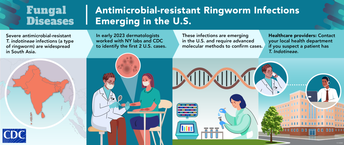 First cases of T. indotineae In early 2023 the first two U.S. cases of antimicrobial-resistant T. indotineae were identified.