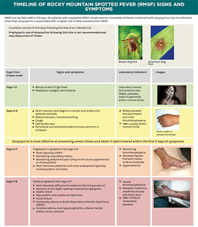 A color chart providing key clinical facts and images to aid in the diagnosis of RMSF.