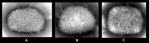 Figure 3 Images of vaccinia virus, smallpox virus, and mpox virus from clinical specimens