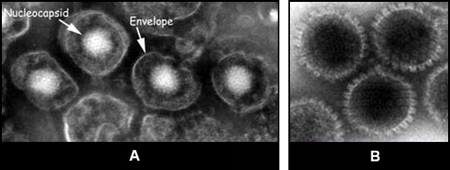 Figure 6 Images of herpesvirus particles from tissue culture