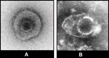 Figure 7 Images of herpesvirus from clinical specimens