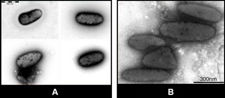 Figure 8 EM images of melanosomes.