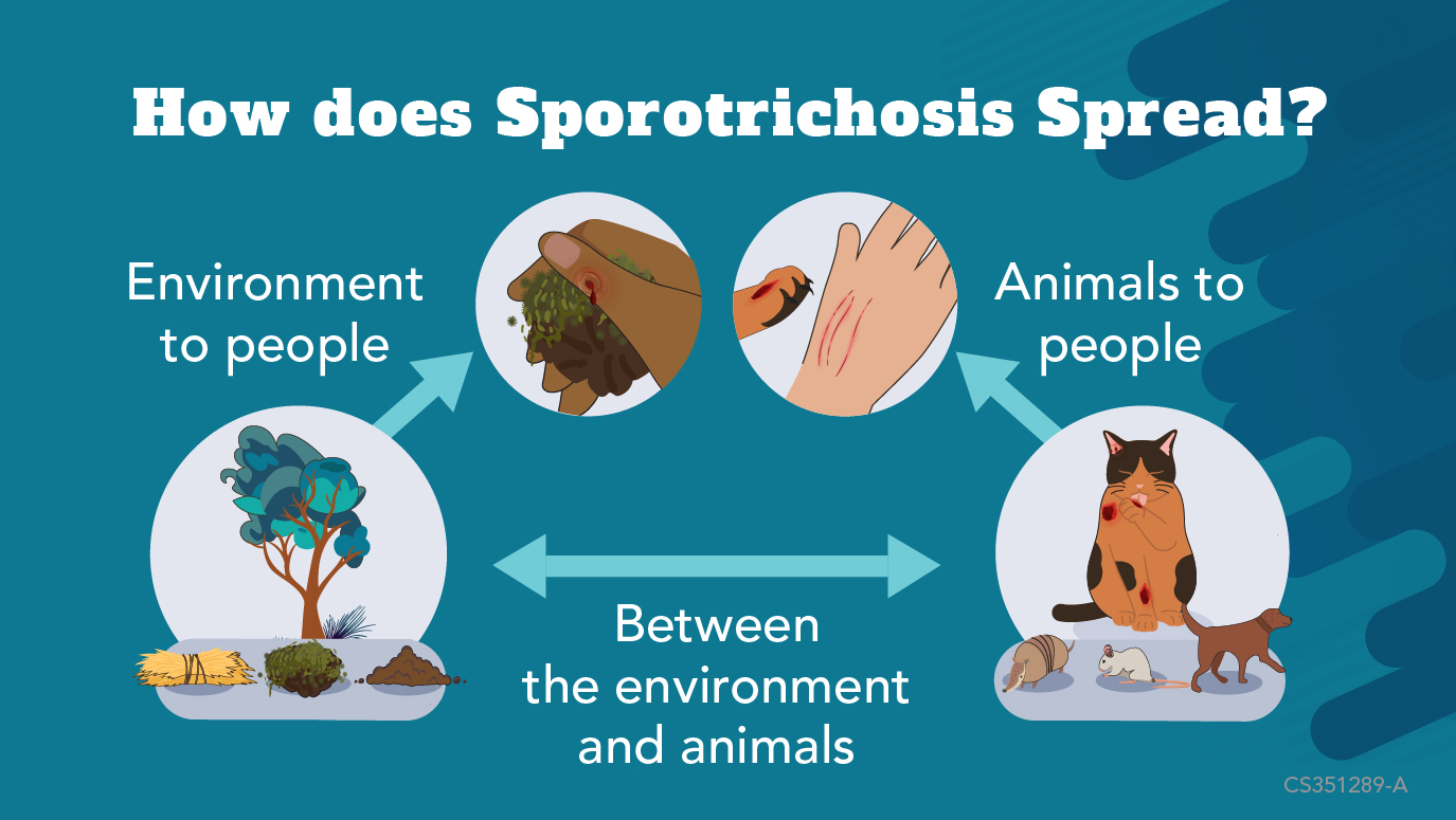 How Sporotrichosis Spreads People get sporotrichosis from the environment or animals. It also spreads between animals and the environment.