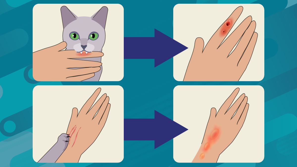 Cat scratches and scrapes can cause sporotrichosis Cat biting and scratching a human hand.
