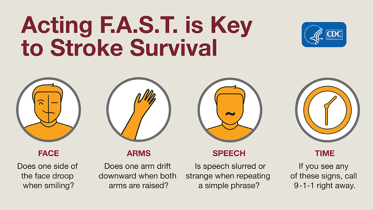 FAST-Graphic Act F.A.S.T. Look for signs in the face (drooping), arms (one cannot stay raised), speech (slurred). Time: call 9-1-1 right away.