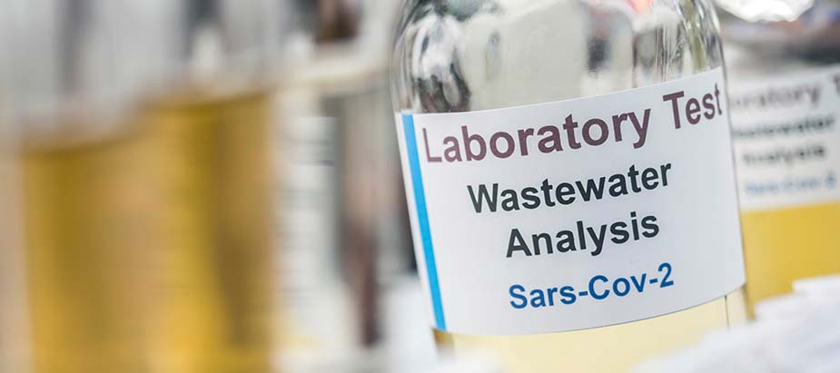 laboratory test wastewater analysis Sars-Cov-2 laboratory test wastewater analysis Sars-Cov-2