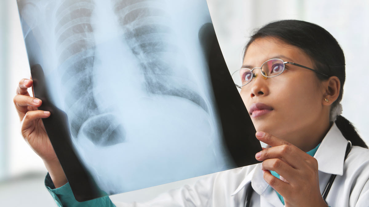Health care provider reviewing x-ray A female health care provider holds a chest x-ray film to the light to examine it.