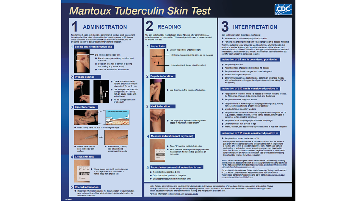 The Mantoux Tuberculin Skin Test Wall Chart provides a convenient reference for health care workers who administer and read the skin test. The first two panels of the wall chart list the key steps in administration and reading of the skin test and features close-up photographs. The third panel describes how to interpret the skin test results.