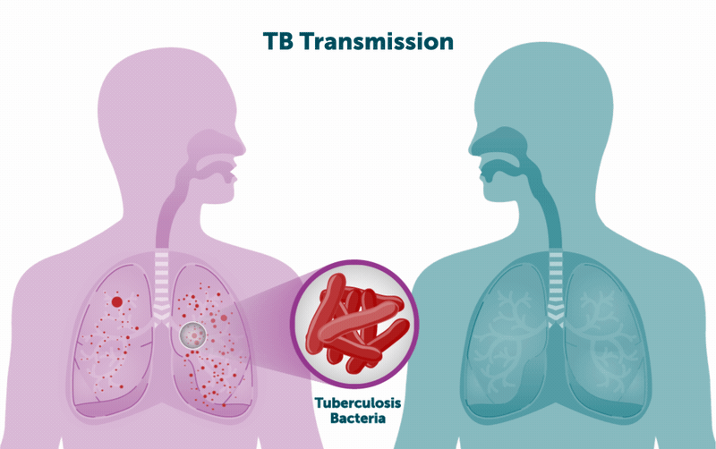 Tuberculosis Transmission An animated graphic shows TB germs spreading from one person to another.