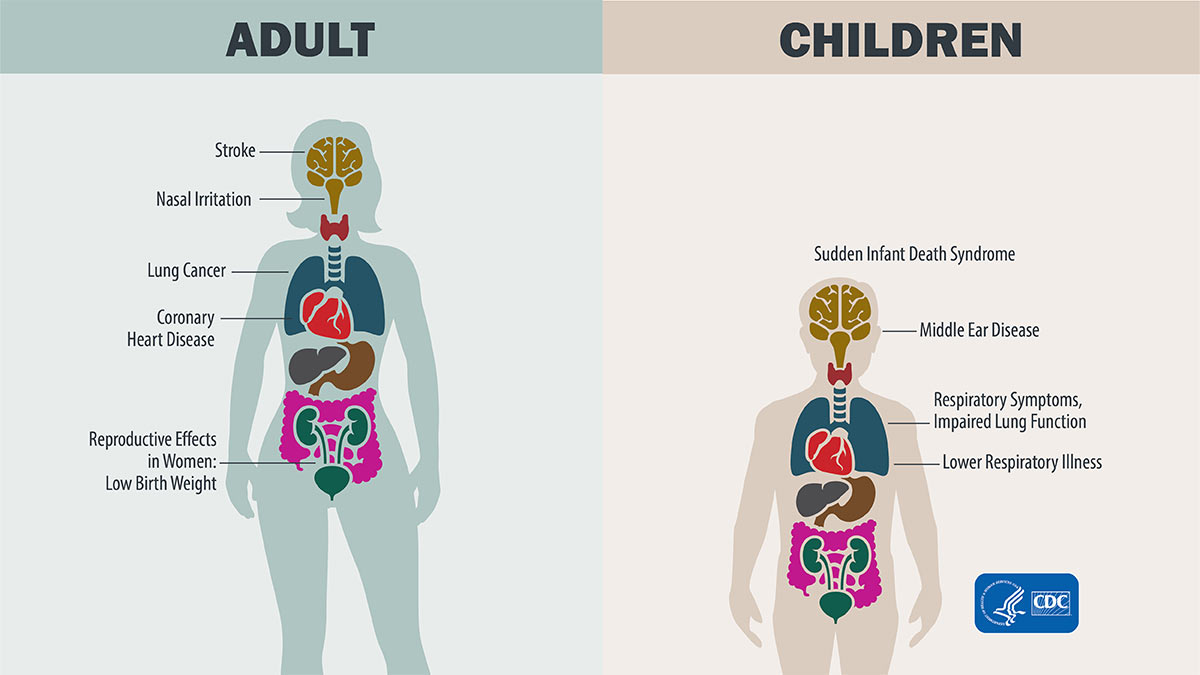 Health Effects of Secondhand Smoke Diagram showing health effects in adult body and child body.