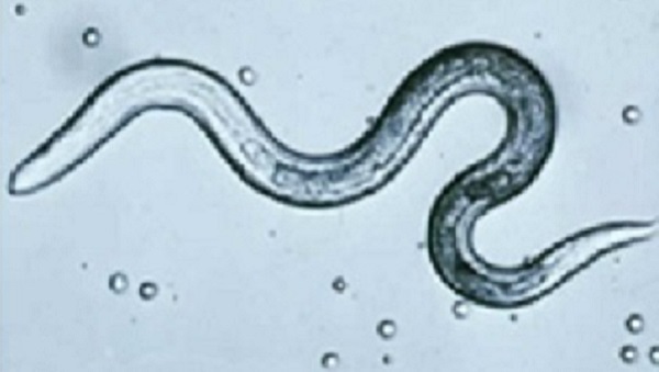 — title missing — toxocariasis