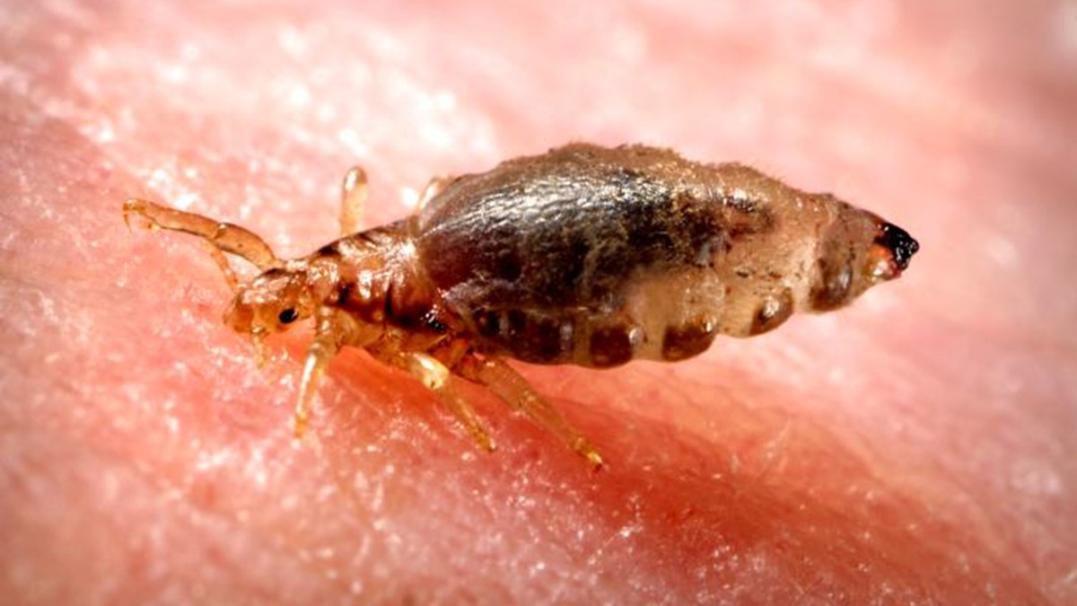 body-lice Pediculus humanus corporis, the human body louse.