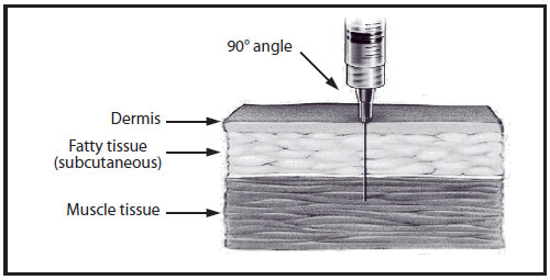 admin-fig-1.jpg This drawing shows intramuscular needle insertion into a cross-section of skin. The needle is inserted at a 90-degree angle and penetrates the dermis, fatty tissue (subcutaneous), and muscle tissue.