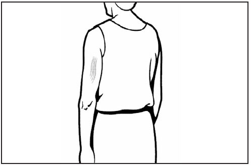 admin-fig-4.jpg This line drawing is a rear/dorsal view of an adult. The triceps muscle of the arm is shaded, showing the proper site for subcutaneous vaccine administration.