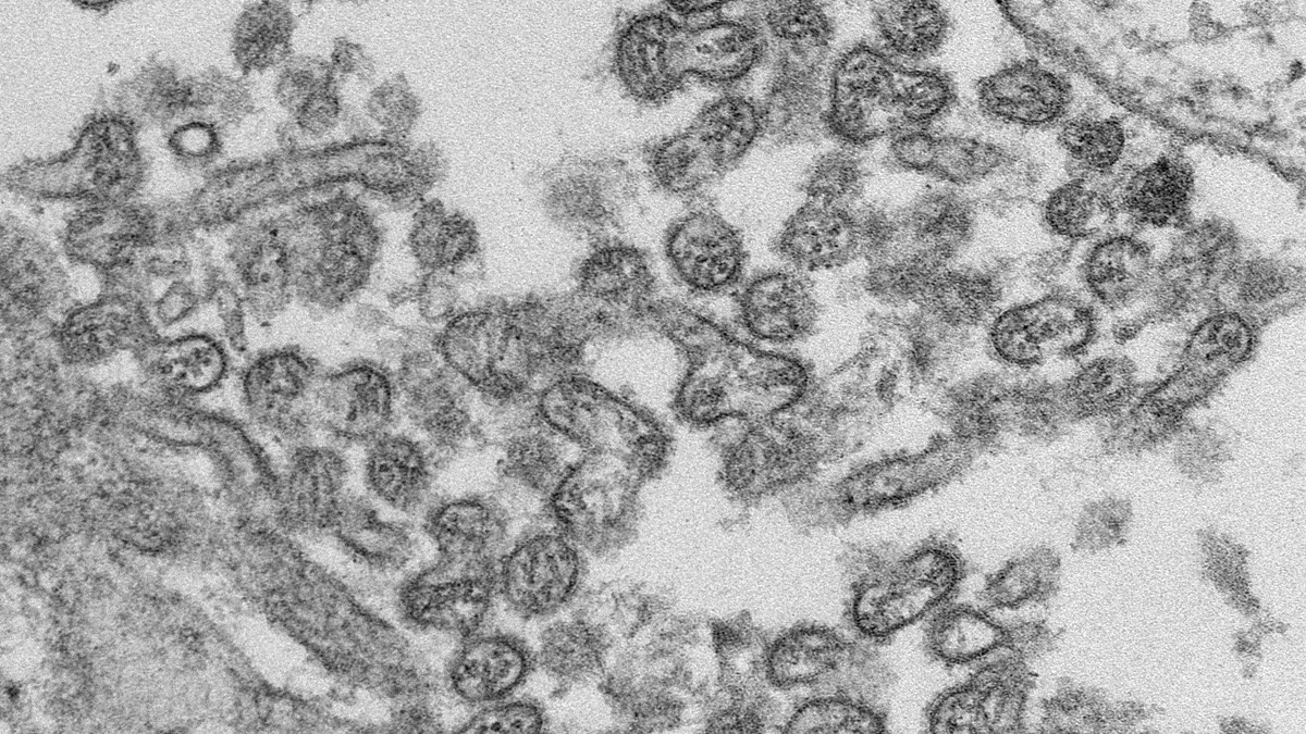 Transmission electron microscopic image of numerous extracellular Bourbon virus particles.