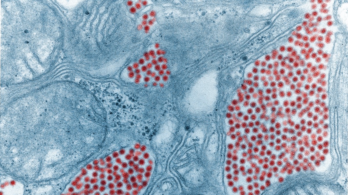 Eastern equine encephalitis virus Eastern equine encephalitis virus in mosquito salivary gland tissue.