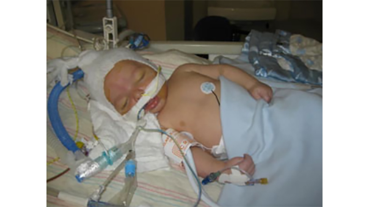 Baby Judah Baby Judah hooked up to machines in the ICU