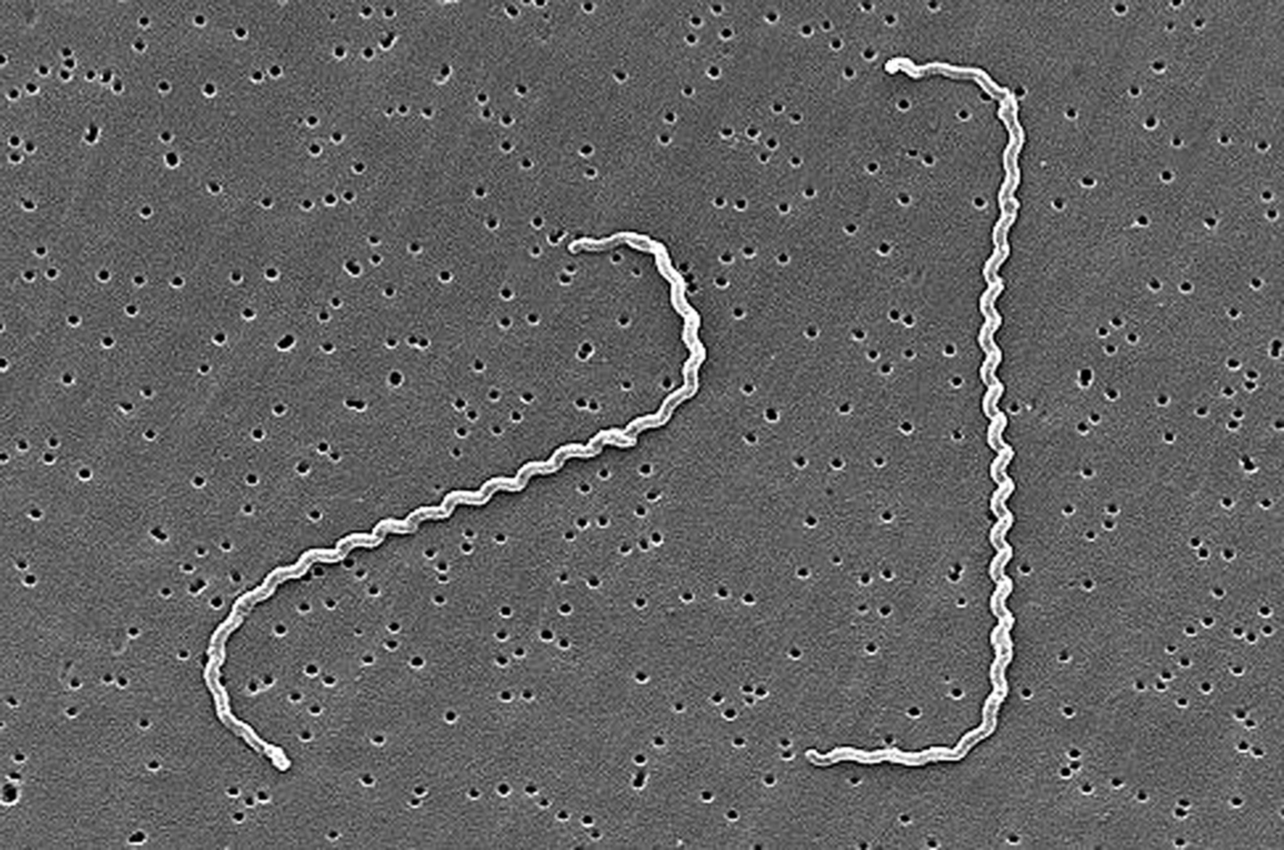 Leptospirosis