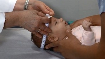 — title missing — Picture of doctor measuring head circumference of an infant.