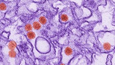 — title missing — A digitally-colorized transmission electron micrograph (TEM) of Zika virus